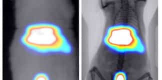 Deep learning algorithms for molecular imaging applications
